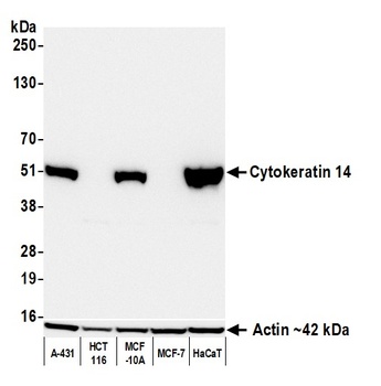 Cytokeratin 14 Antibody 抗体，orb