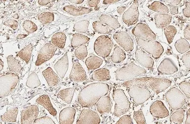 Glucocorticoid Receptor antibo