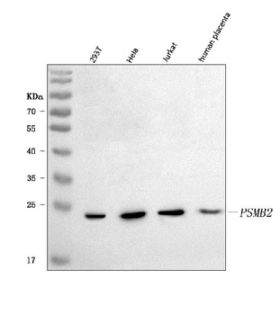 PSMB2 Antibody 抗体，orb1728104，B