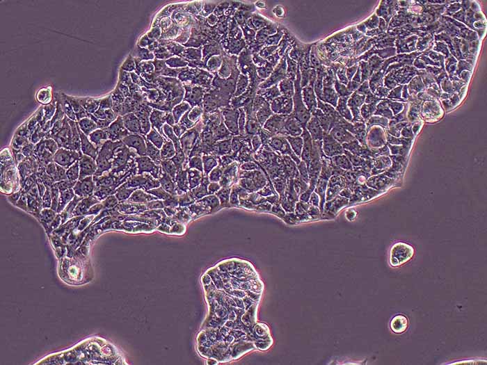 Calu-3人肺癌细胞（STR鉴定正确）