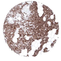 Parathyroid Hormone antibody [