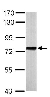 Rabbit anti Human HSP70 Polycl