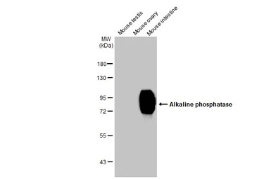 Alkaline phosphatase (intestin