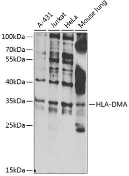 HLA-DMA Antibody 抗体，orb1254359