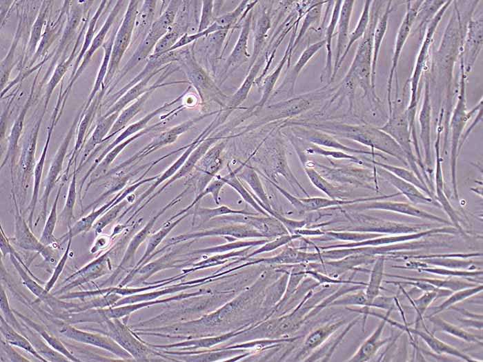 HSF细胞图片