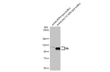 Rb antibody [HL2465]