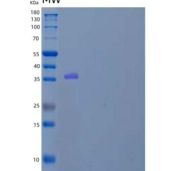 人胞质磺基转移酶家族1A成员3重组蛋白