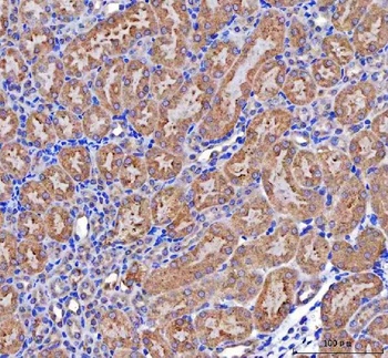 Anti-MCCC2 Antibody 抗体，orb1786