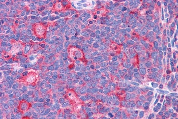 TPD52L2 Antibody 抗体，orb1247626