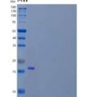 小鼠组织金属蛋白酶抑制因子2(TIMP2)重组蛋白C-6His