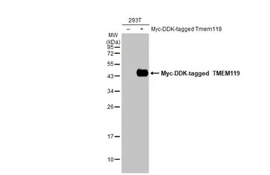 TMEM119 antibody [HL2415]