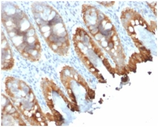 Cytokeratin 8 + 18 antibody [r