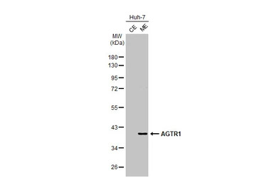 AGTR1 antibody [HL2524]