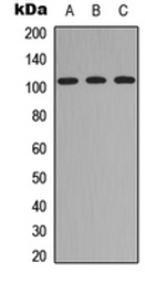 ITIH4 antibody