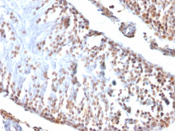 Wilms Tumor 1 antibody [6F-H2]
