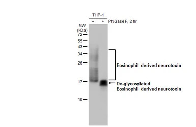 Eosinophil derived neurotoxin 