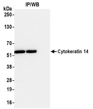 Cytokeratin 14 Antibody 抗体，orb