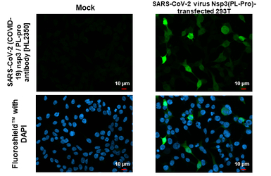 SARS-CoV-2 (COVID-19) nsp3 / P