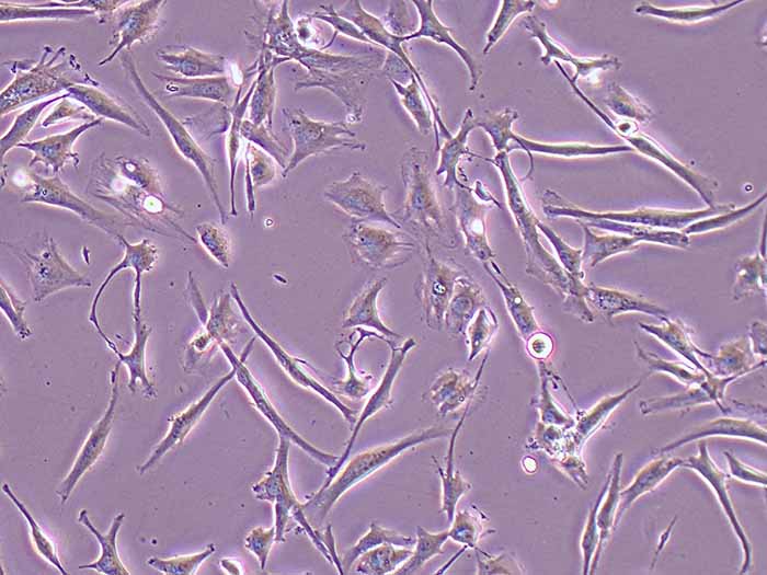 U-118 MG细胞图片