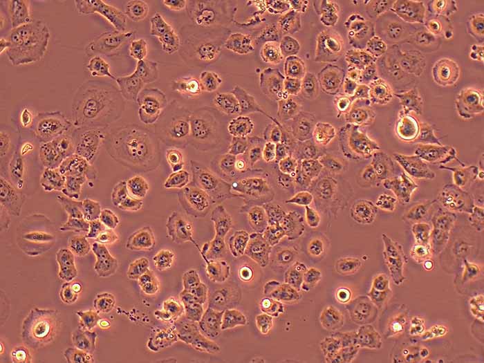 NCI-H23细胞图片