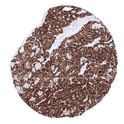 Parathyroid Hormone antibody [