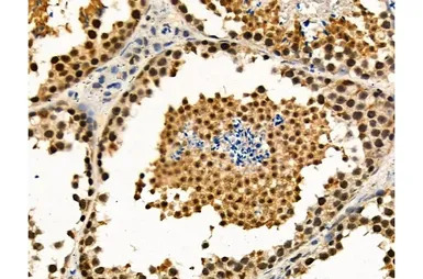 Ki67 (phospho Thr1335) antibod