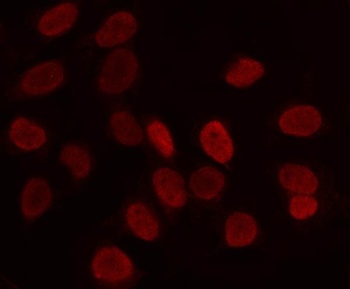Anti-LRIG2 Antibody 抗体，orb1804