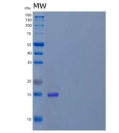 人淀粉样β A4前体蛋白结合A3/APBA3/X11-γ重组