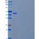 人异柠檬酸脱氢酶【NADP】细胞质重组蛋白
