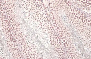 U2AF65 antibody [HL1583]