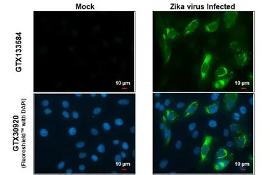 Zika virus prM protein antibod