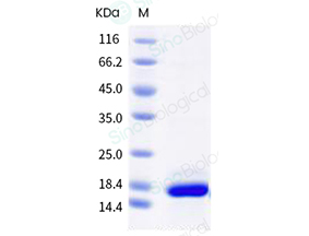 重组人 Interleukin-21 / IL-21 蛋白