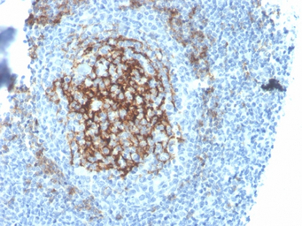 CD23 antibody [FCER2/4395R]
