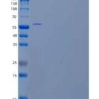 人嗅觉调节素-4（Olfactomedin-4）重组蛋白