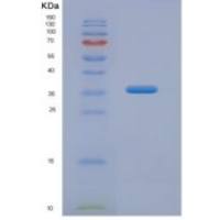 人精氨酸酶(ARG)重组蛋白