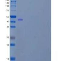 人异柠檬酸脱氢酶1(IDH1)重组蛋白C-8His