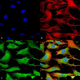 ATP7b antibody [S62-29]