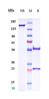 Anti-Amyloid Beta Reference An