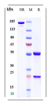 Anti-Shiga toxin (E.coli) Refe