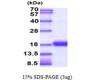 Human UBE2D1 protein, His tag