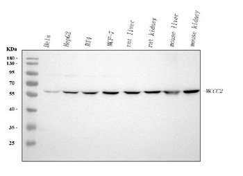 Anti-MCCC2 Antibody 抗体，orb1786