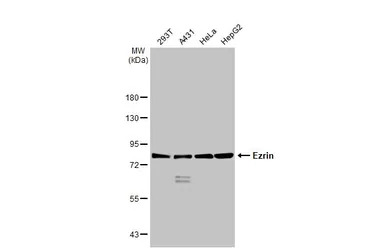 Ezrin antibody [HL2327]