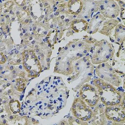 alanyl-tRNA synthetase antibod