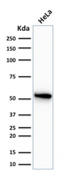 Cytokeratin 7 antibody [OV-TL1