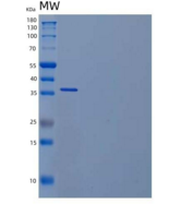 小鼠乳酸脱氢酶A/LDH1(LDHA)重组蛋白C-6His