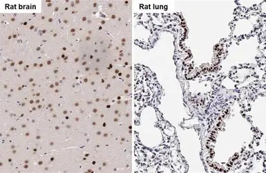 SOX2 antibody [HL1193]