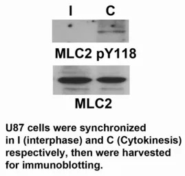 Myosin Light Chain 2 (MLC-2v) 