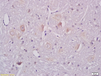 ganglioside GM1 antibody