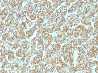 EpCAM antibody [EGP40/1555R]