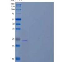 人早期生长反应蛋白1/EGR1/ZNF225重组蛋白N-6His